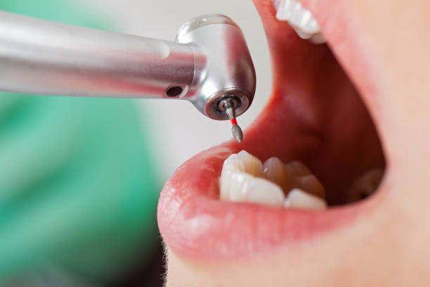 Best Emergency Treatment for Jaw Pain or Injury in Cuthbert, GA